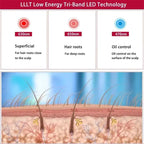 Hot Sale Hair Regrowth Machine 48Leds Red and Blue Light Hat Full Scalp Treatment Therapy Cap for Hair Loss Therapy Hat
